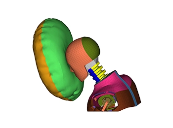 Altair Radioss impact simulation visualising structural response under extreme force conditions.